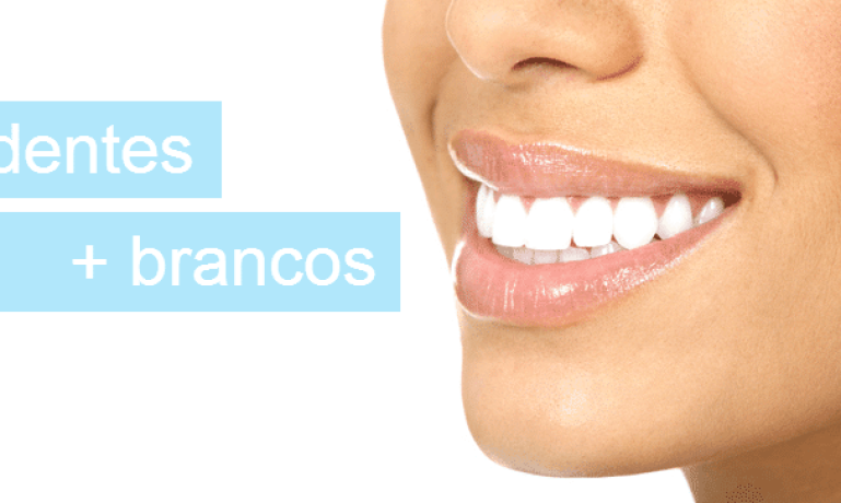 Como clarear os dentes - clareamento dental